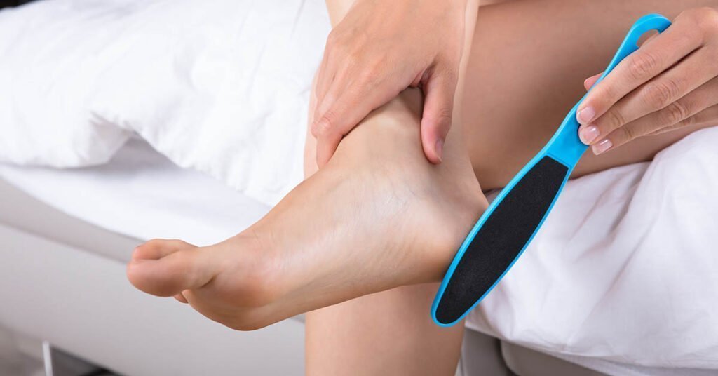 Removing calluses with callus file - steps for home treatment